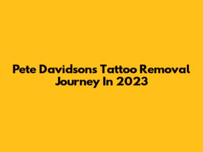 Pete Davidson's Tattoo Removal Journey In 2023