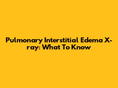 Pulmonary Interstitial Edema X-ray: What To Know